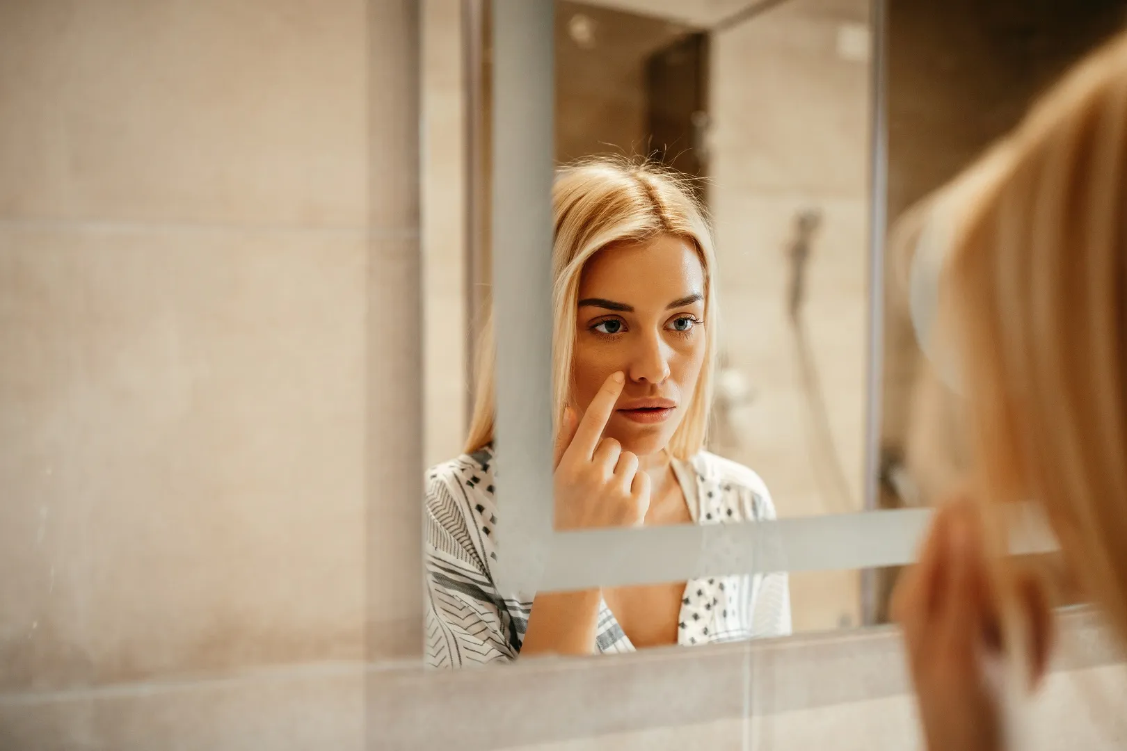 How to get rid of summer zits